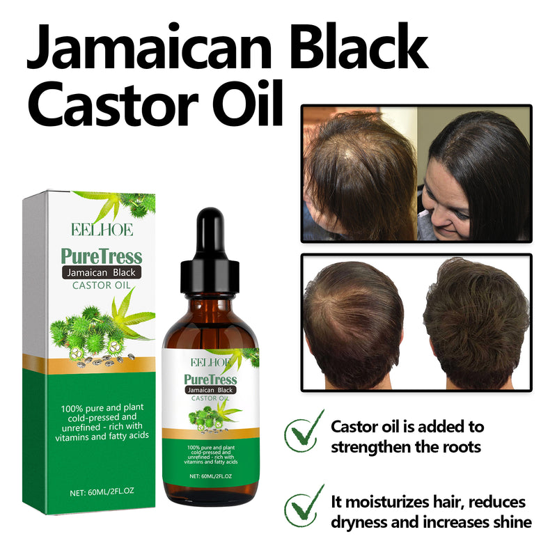 Jamaican Black Castor Oil, Moisturize Scalp And Prevent Dry Hair Thick And Solid Hair Beautiful And Shiny Easy To Absorb Essential Oils