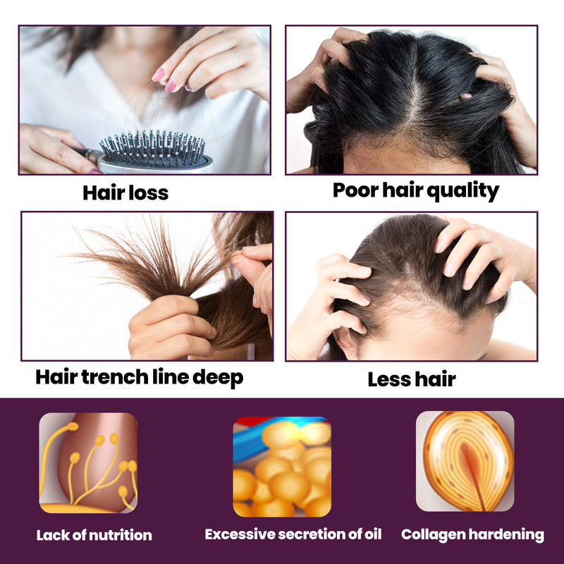 Hair Nutrition Growth Foam, Nutrition Strengthens Hair, Prevents Hair Loss And Irritates Hair Follicles