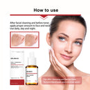 Mandelic Acid Daily Update Essence, Acne-Removing And Acne-Closing Repair Brightening Fruit Acid Essence