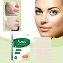 Anti-Acne Pimple Patch, Suitable For Acne Skin Facial Skin Care Portable Cover Acne Small Round Patch