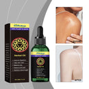 Herbal Massage Treatment Oil, Daily Moisturizing And Moisturizing Skin Herbal Body Massage Treatment Oil