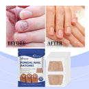 Nail Care Patches Gently Repair Nails For Easy Daily Cleaning With Simple Care Patches