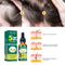 Ginger Hair Essential Oil Moisturizes And Softens Hair And Repairs Frizzy Damaged Hair