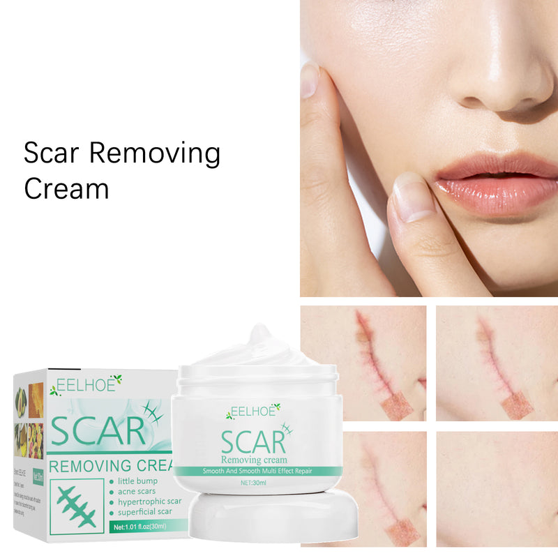 Scar Repair Cream, Fade Burn Scars Postoperative Scar Marks Skin Smoothing Repair Cream